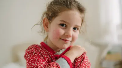 Strategies for Managing Childhood Eczema at Home