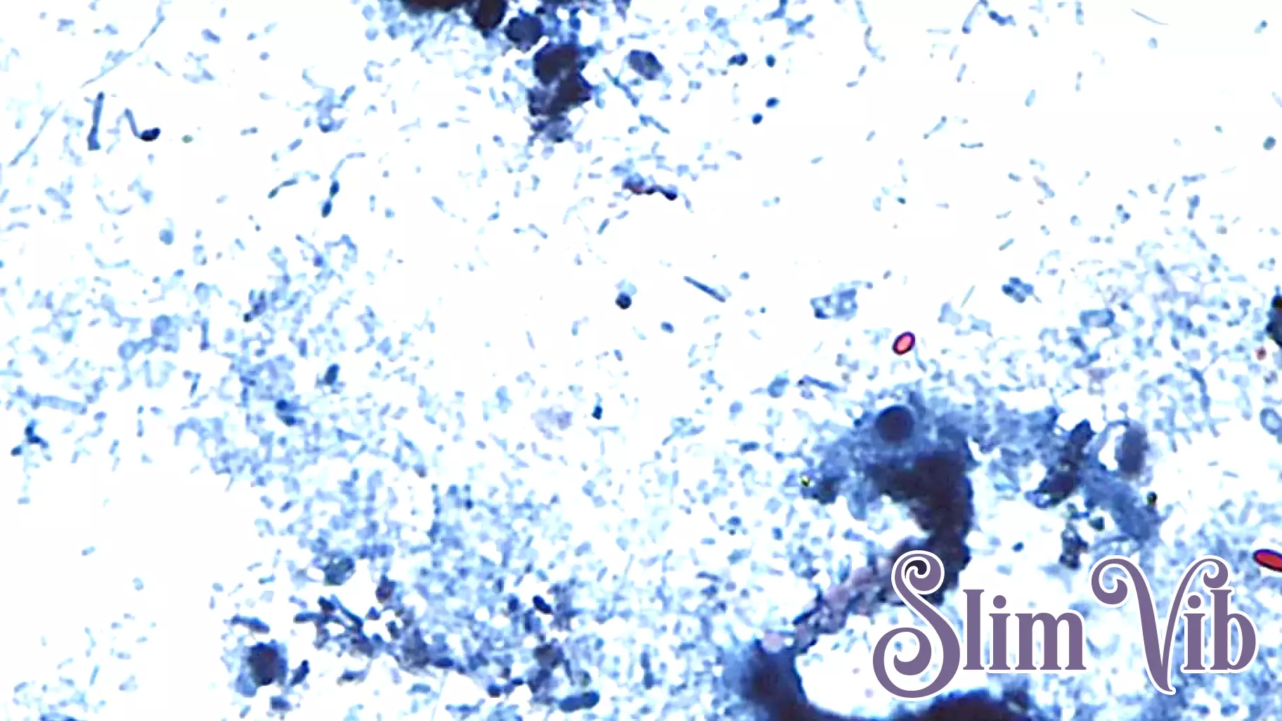 Cyclospora in Maryland: Health officials report 110 cases