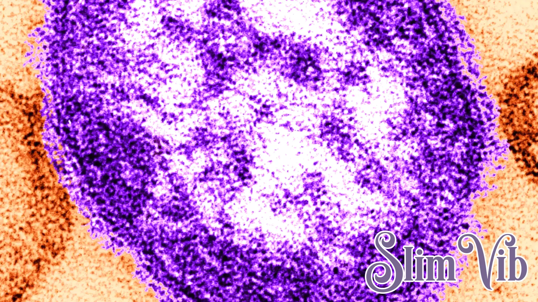 Measles Case Confirmed in D.C. Following International Travel