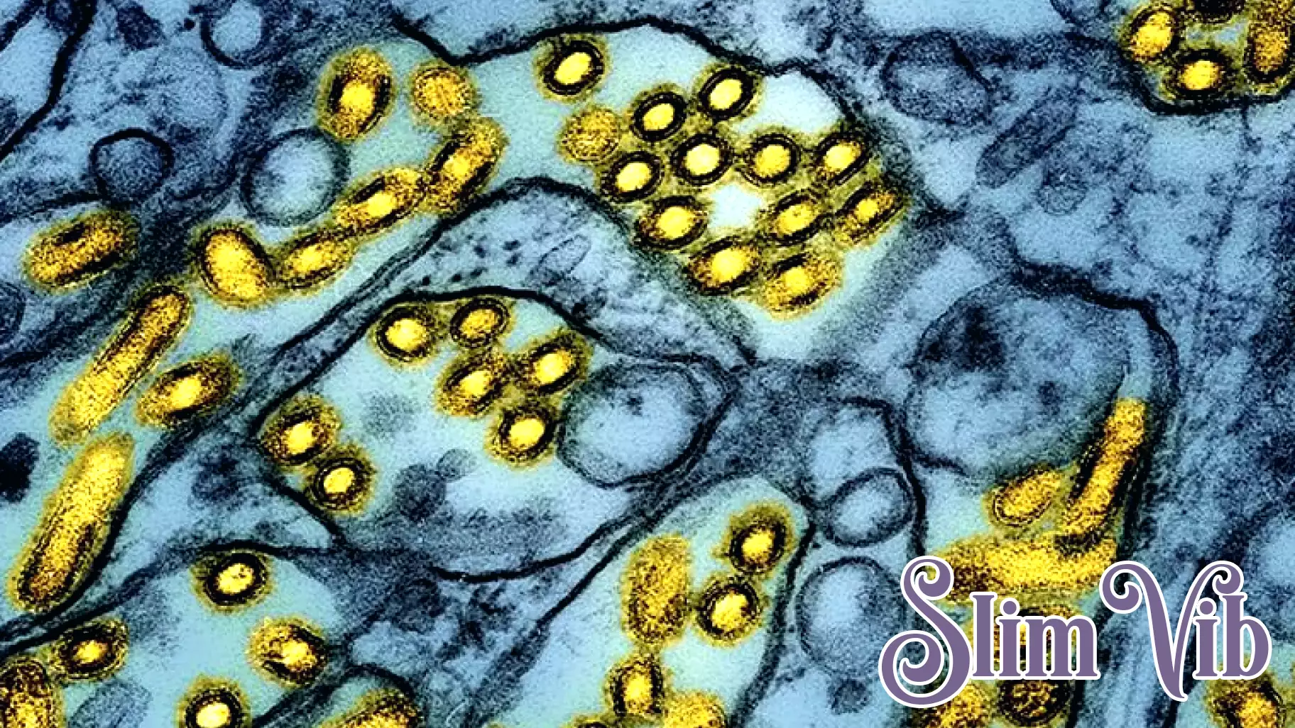 Tragic Death in Washington Linked to Unprecedented Bird Flu Strain