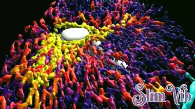 3D human liver reconstruction reveals changes in cirrhosis