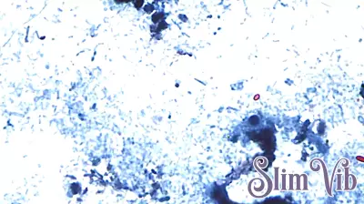 Cyclospora in Maryland: Health officials report 110 cases