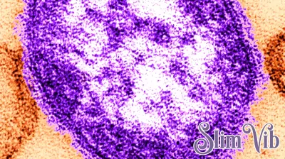Measles Case Confirmed in D.C. Following International Travel