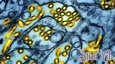 Tragic Death in Washington Linked to Unprecedented Bird Flu Strain