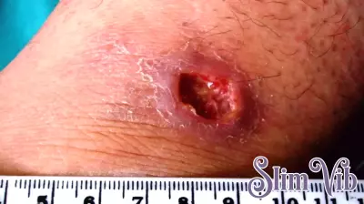 World Health Assembly Advances Key Resolutions on Health Finance and Disease Management